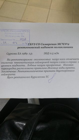 Гайморит