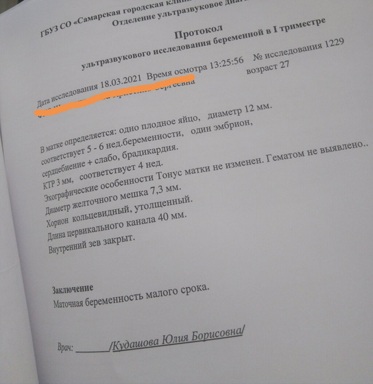 Месяц моего ада. Не делайте так рано узи.