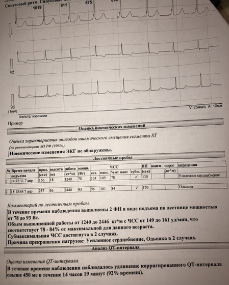 Забрала результаты холтера+АД ?