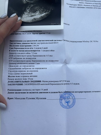 Сходила на первое узи.