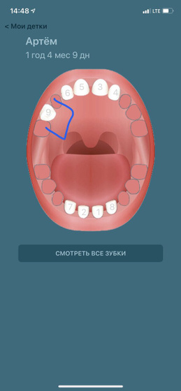 Зубыыыыыы ?