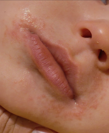 Мамы, может у детей