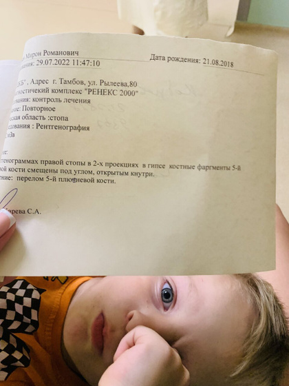 Перелом