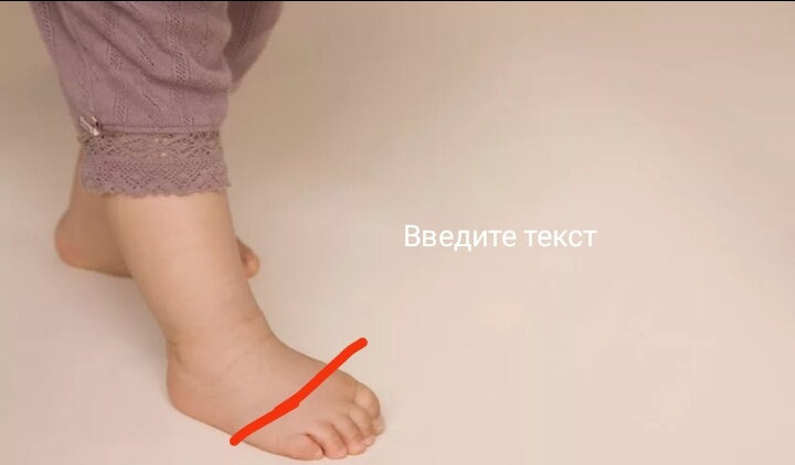 Девочки, у младшего сына