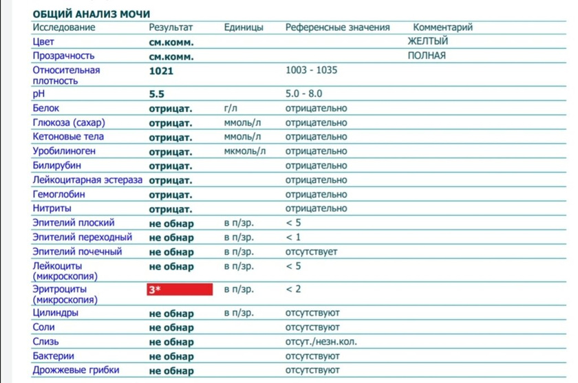 Кто нибудь понимает результат?