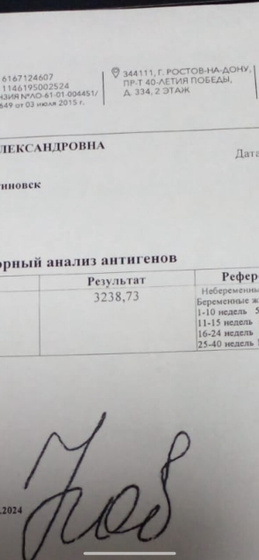 Нормальный у меня хгч