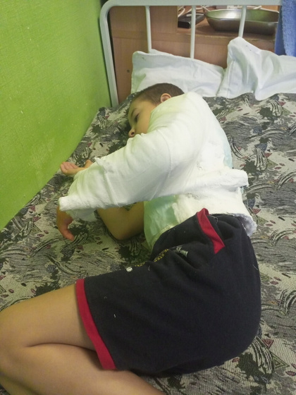 Операция по удалению костной кисты💉