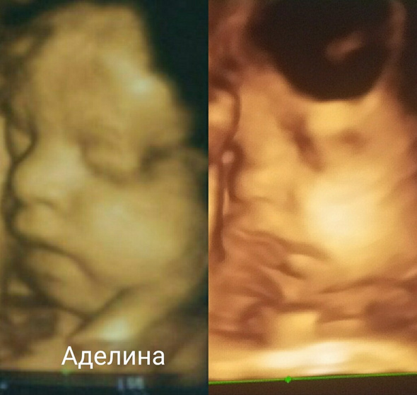 Одно лицо))