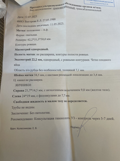 Ну это пипец ? Я в шоке от узи