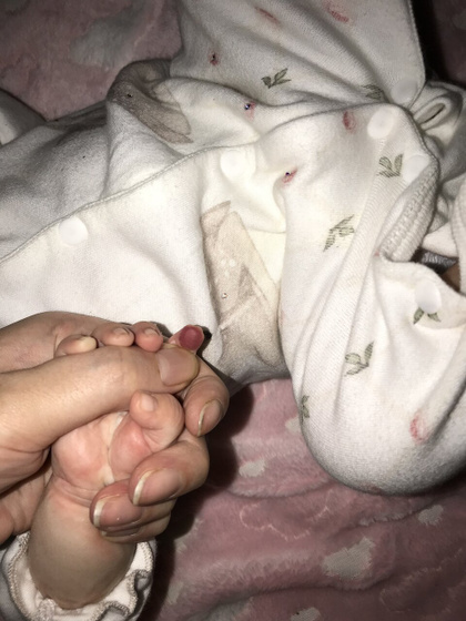После родов недели через