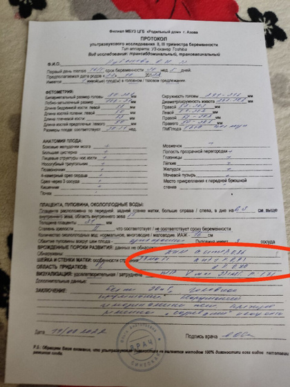 Узи в 30 недель
