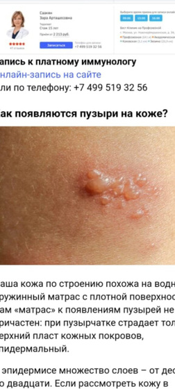 Девочки, что это и