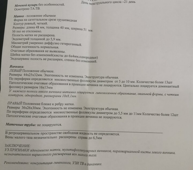 Оставлю заметку для себя.