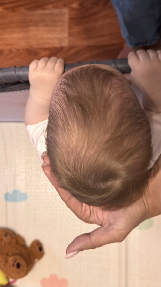 Малышка набила себе шишку на голове