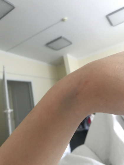Чем можно полечить Вены?все