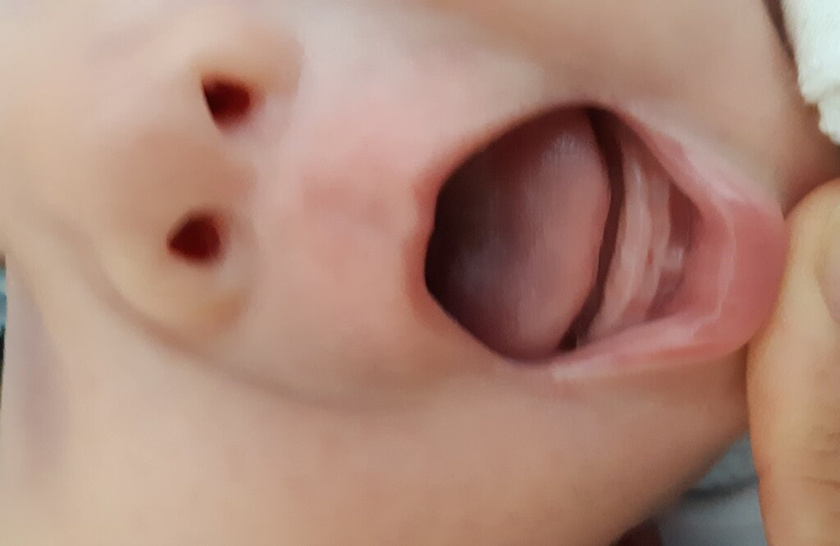Не зубы ?