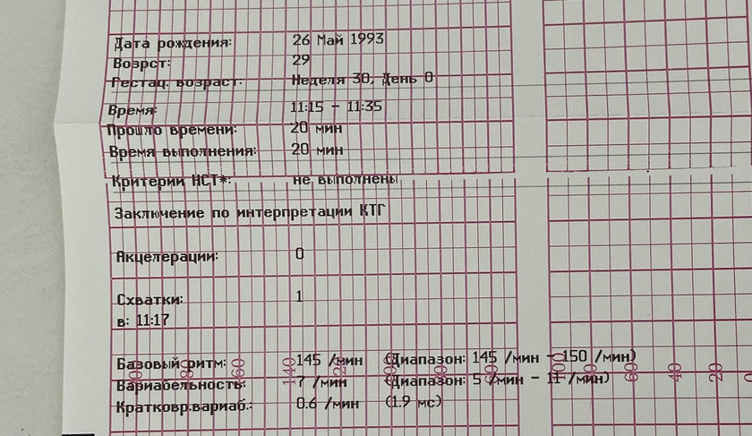 Была сегодня на ктг