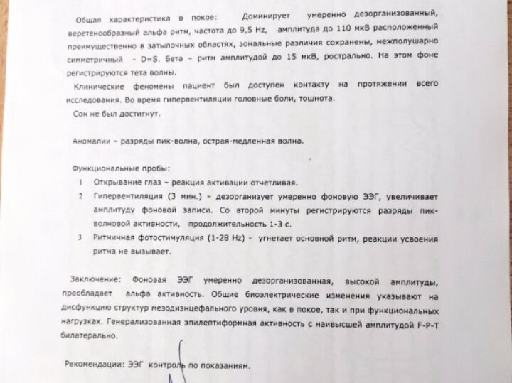 Компьютерная видео ЭЭГ.