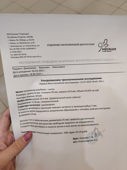 Узи