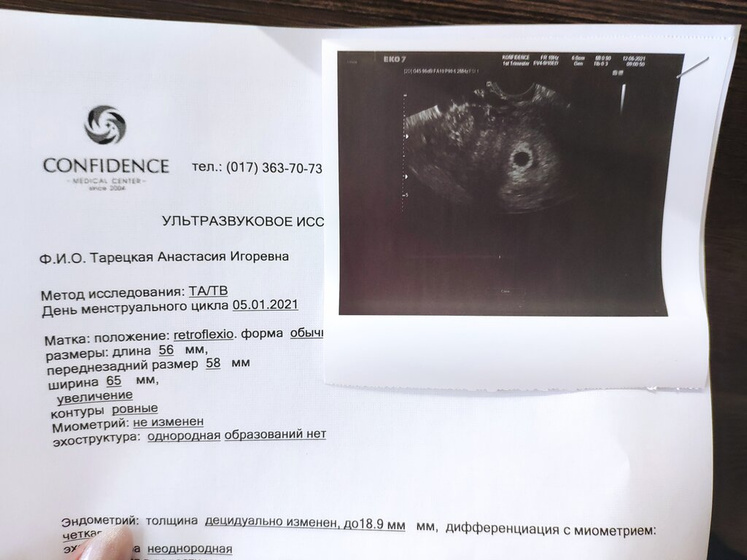 Сходила на УЗИ, срок 5 Нед. 5 дней