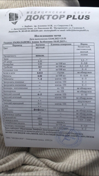Анализ мочи