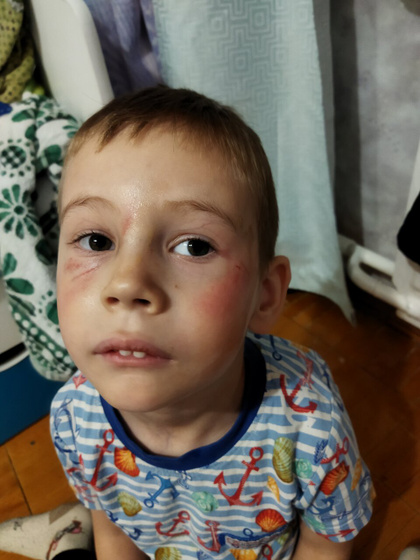 Мой очкарик) и мой раненый боец🤕😆