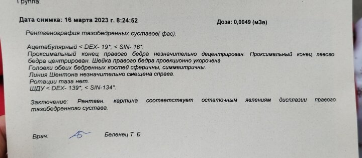 Остаточные явления дисплазии ТБС