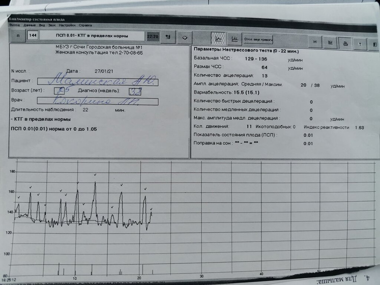 38 недель, КТГ