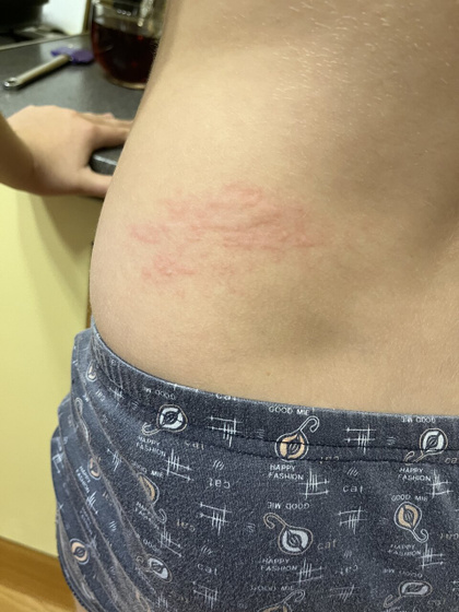SOS?