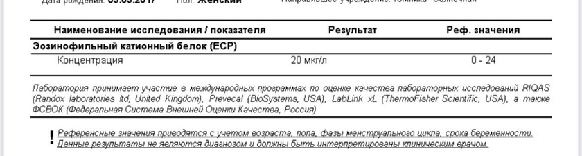 Сухой кашель, не могу найти причину