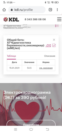 Итак, результаты следующие.