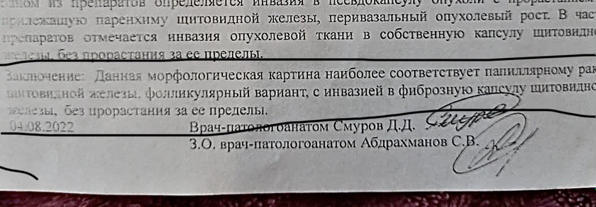 Рак щитовидной железы?