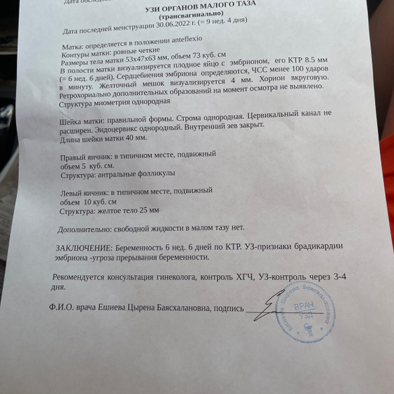 Брадикардия, чсс менее 100 ударов