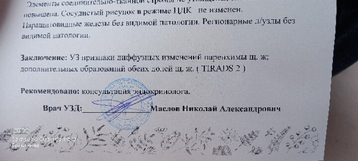 Начинает вырисовывается картина.