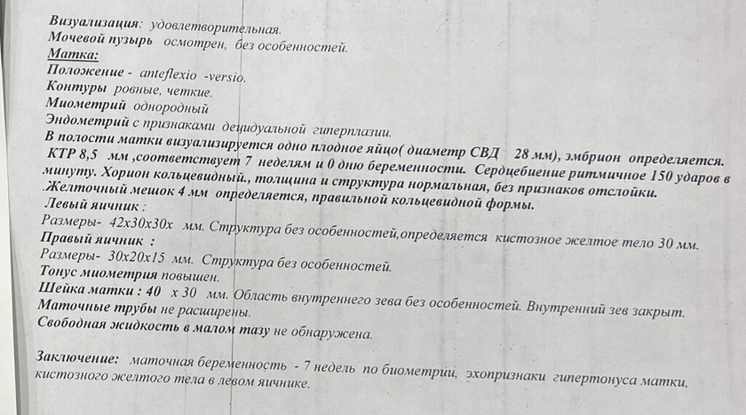 Гиперплазия
