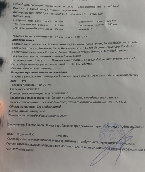 Симфизита нет ?? есть селалтщный нерв