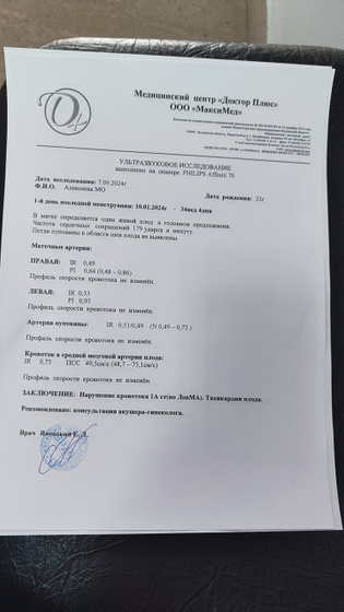 Доплер