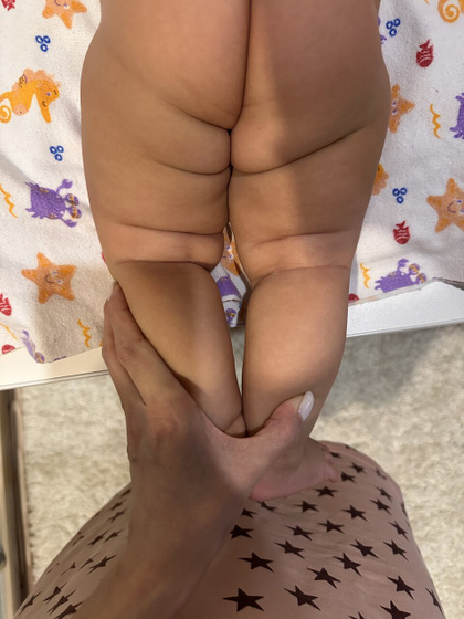 Складочки