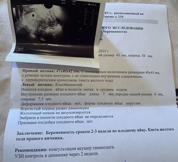 Когда же уже будет