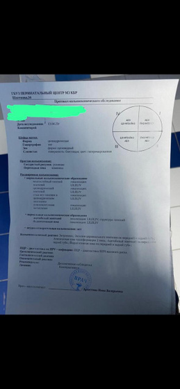 Кольпоскопия