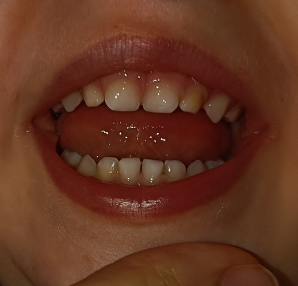 Про зубки 🦷👄