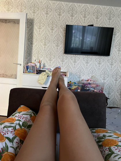 Отеки.