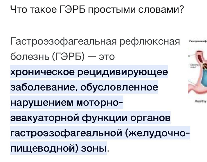 У кого тоже ГЭРБ?( рефлюкс)
