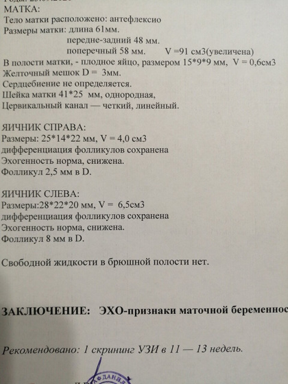 Сходила я на узи!