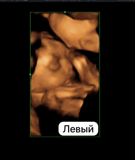 3Д узи это вещь 😍😍😍