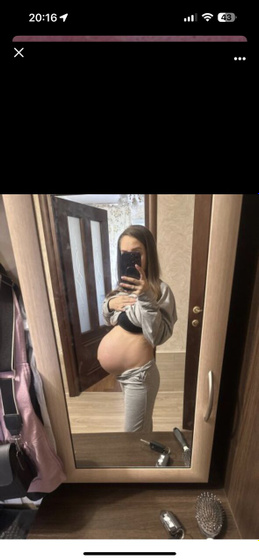 Роды?