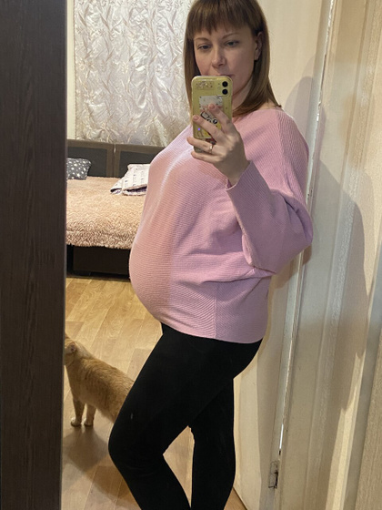 34 недели и узи?