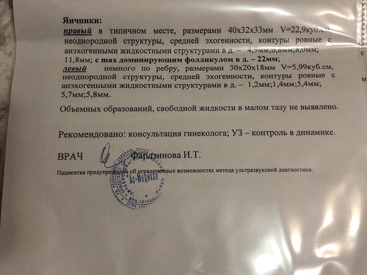 Девочки ,была на узи