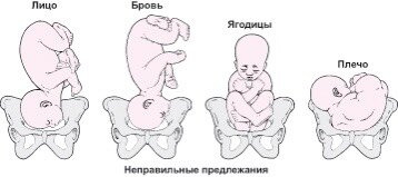 На узи показало что