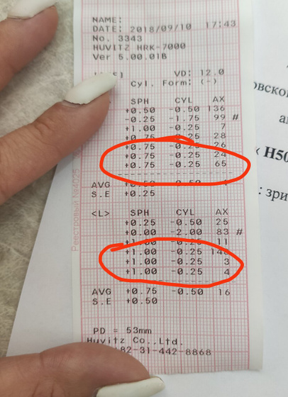 Проверили зрение :+1 - 0.25 и + 0.75 - 0.25. Кто нибудь знает насколько это плохо? Нужны ли очки?